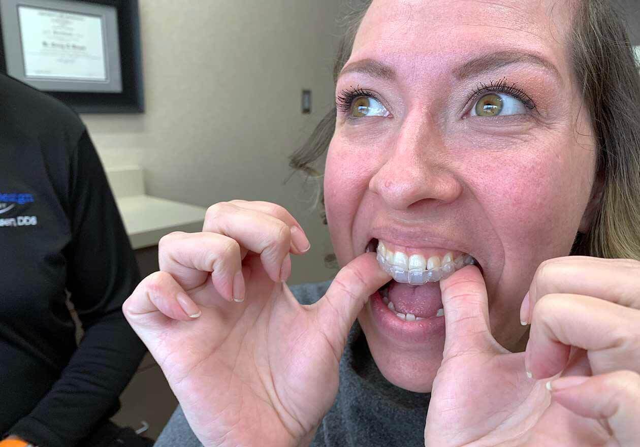 Invisalign attachments are small buttons that help your aligners to grip  your teeth and achieve more complex movements. As you can see, they're  very