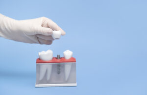 A hand in a white glove holds a model of a tooth implant blue table and background